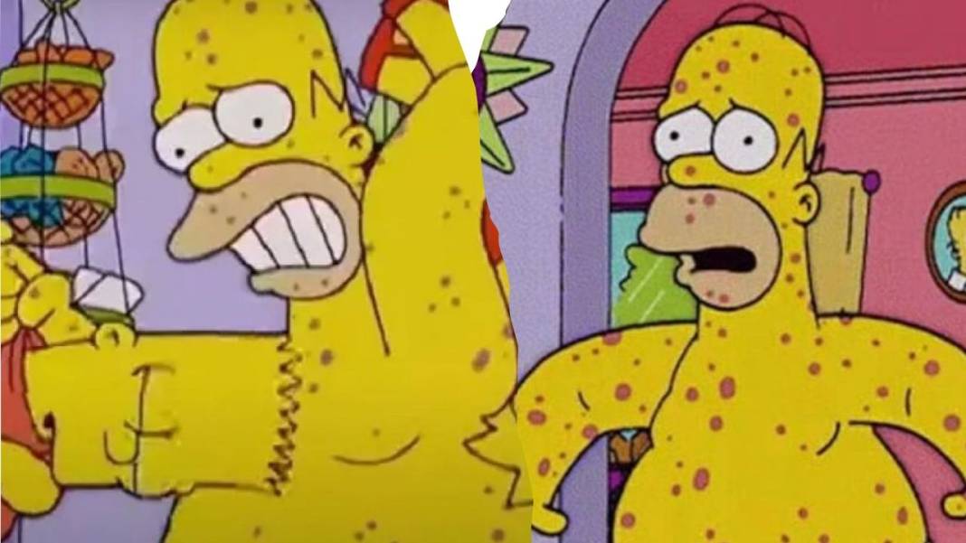 The Simpsons yine şaşırttı: Maymun çiçeği virüsü sahnesi gündem oldu! 4