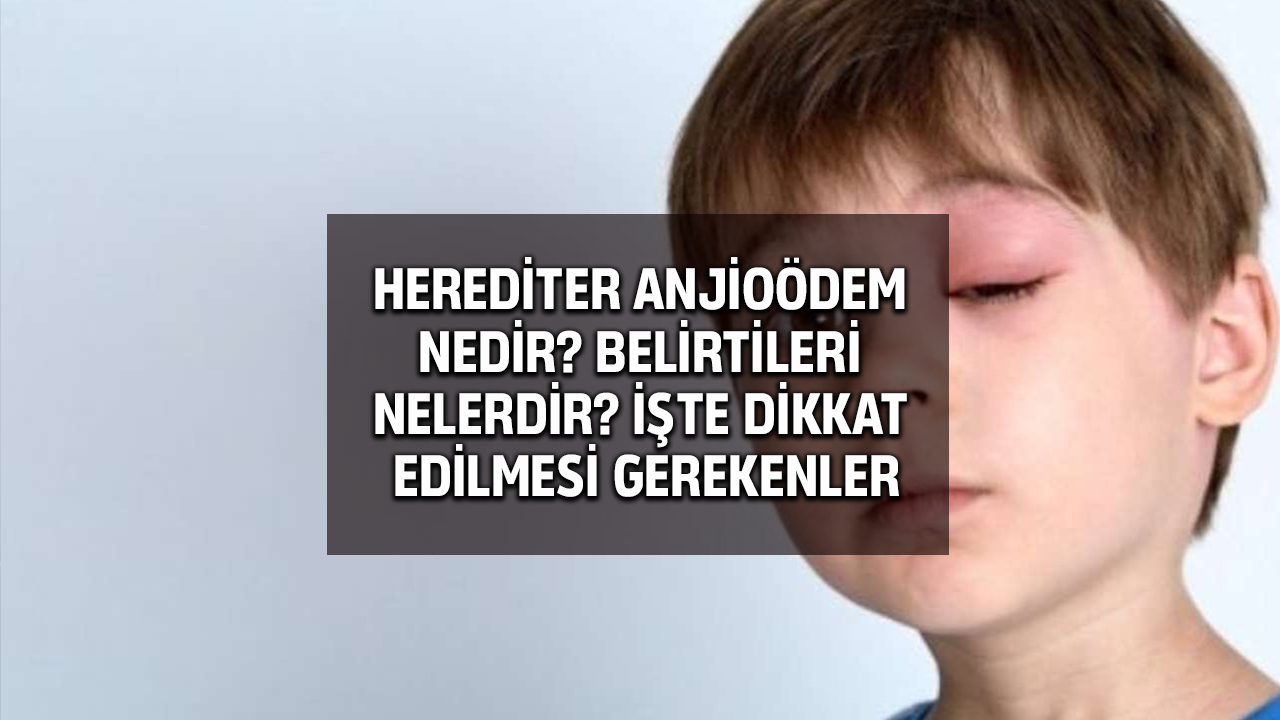 Herediter Anjioödem hastalığı nedir? Belirtileri nelerdir?